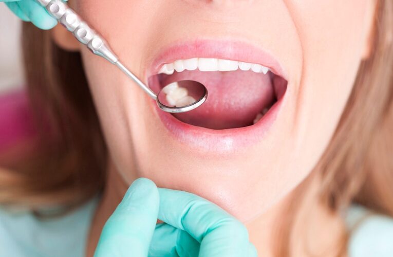 Symptoms, causes and prevention of cavities to improve dental health
